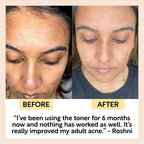Face Toner with Hyaluronic Acid